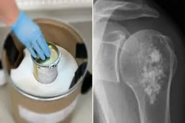 innovador medicamento para el tratamiento de cáncer