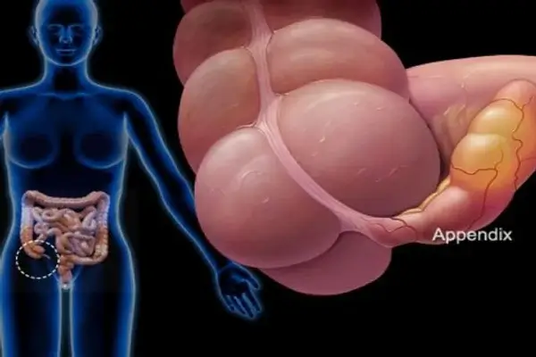 apéndice
