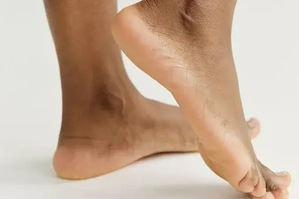 El desgaste interno del talón una alerta de tu salud