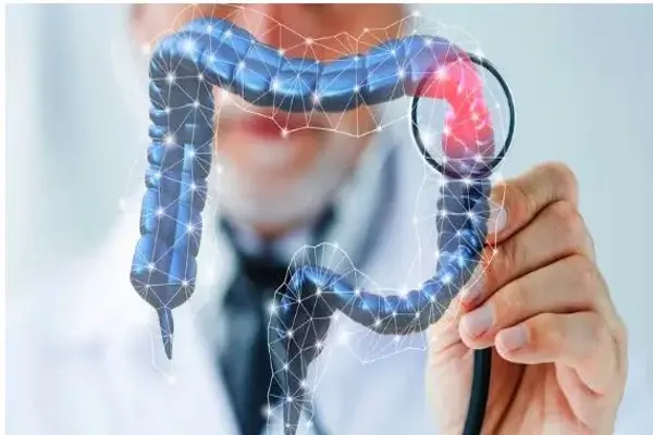 Cáncer de colon aumenta entre los adolescentes estadounidenses